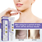 Retinol Neck Cream, Reduces Neck Lines, Moisturizes And Tightens Neck Skin Neck Massage Cream
