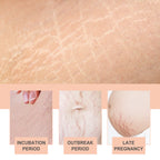 Snail Essence Pregnancy Stretch Mark Cream, Firming Skin Repair Lighten Postpartum Pregnancy Marks And Gestational Fat Smoothing Cream
