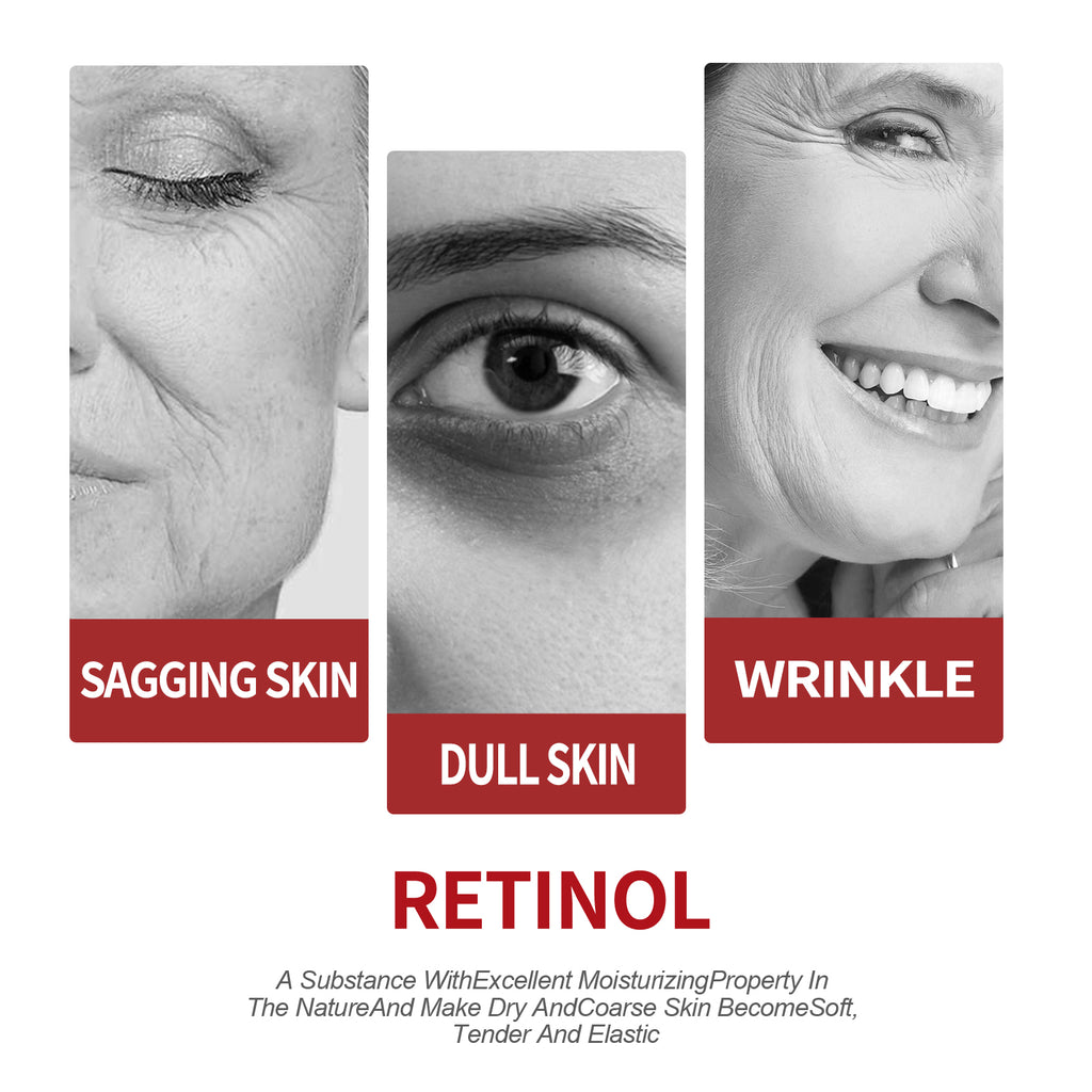 OUHOE Retinol Moisturizing Cream To Reduce Fine Lines, Dark Circles, Moisturize, Tighten Pores And Prevent Aging