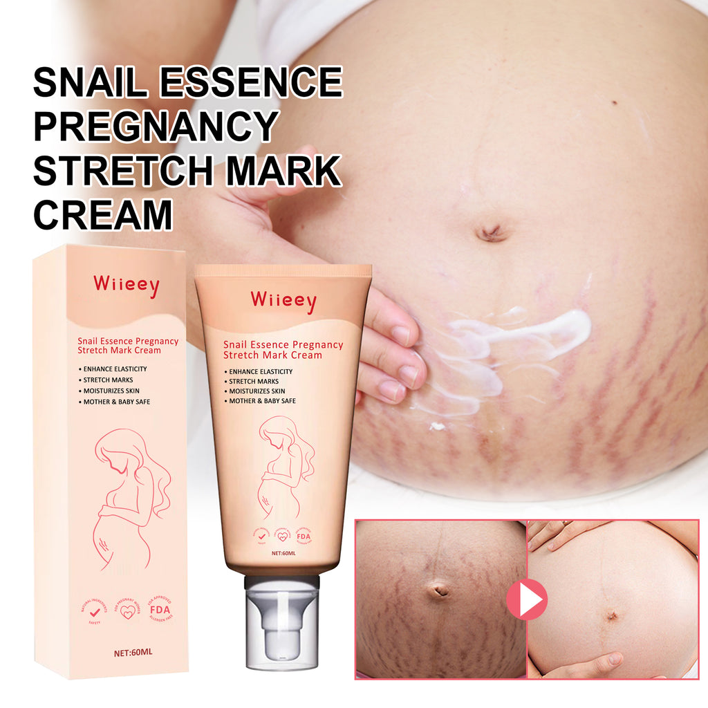 Snail Essence Pregnancy Stretch Mark Cream, Firming Skin Repair Lighten Postpartum Pregnancy Marks And Gestational Fat Smoothing Cream