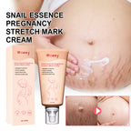 Snail Essence Pregnancy Stretch Mark Cream, Firming Skin Repair Lighten Postpartum Pregnancy Marks And Gestational Fat Smoothing Cream