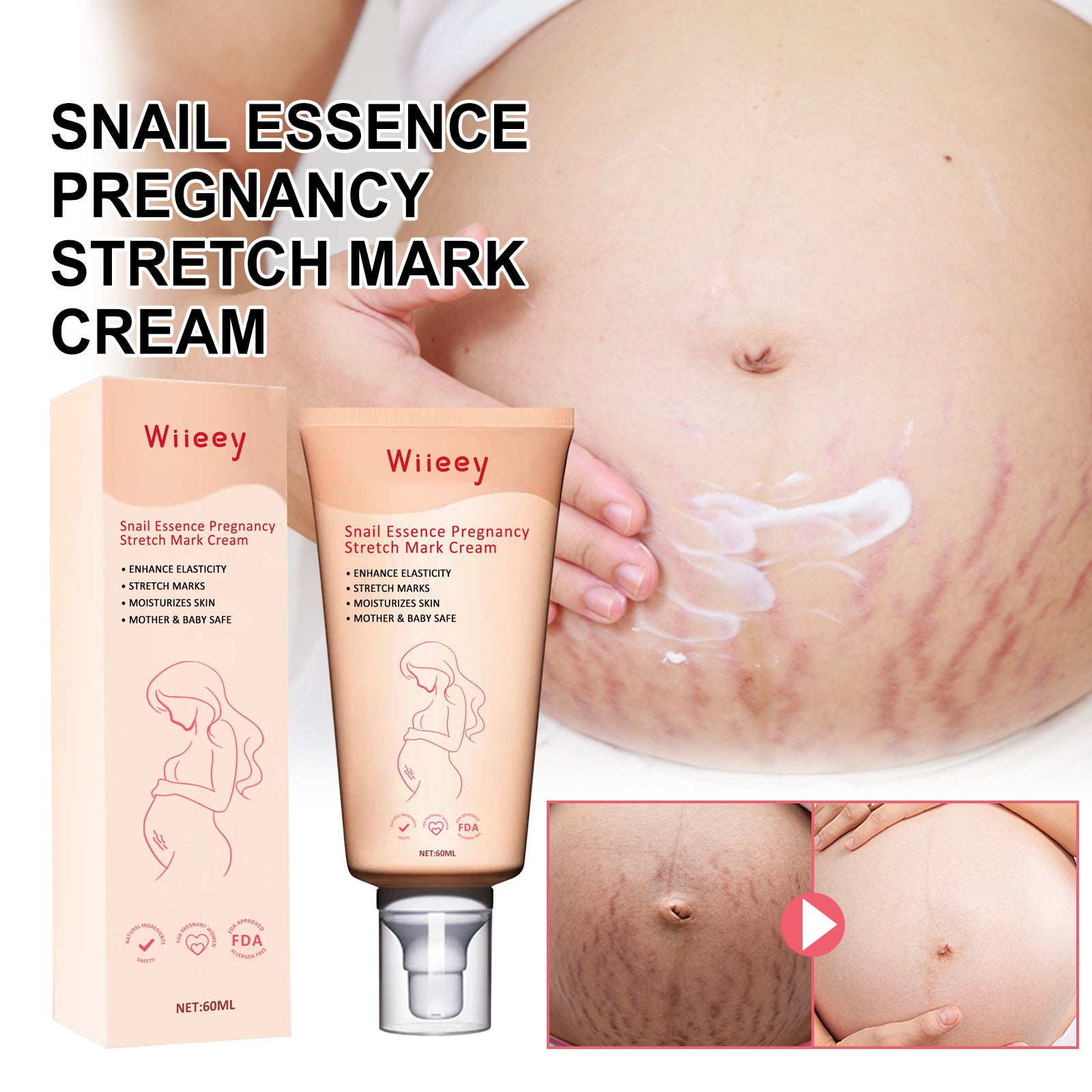 Snail Essence Pregnancy Stretch Mark Cream, Firming Skin Repair Lighten Postpartum Pregnancy Marks And Gestational Fat Smoothing Cream